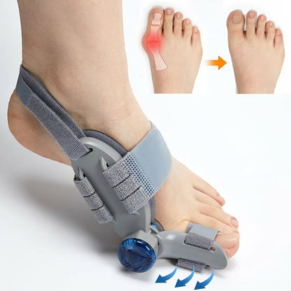 AliviaPie Elite – Corrector de Juanetes Ajustable para Alivio del Dolor y Realineación del Dedo Gordo